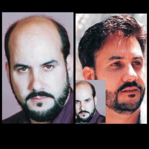 Man - Before and After